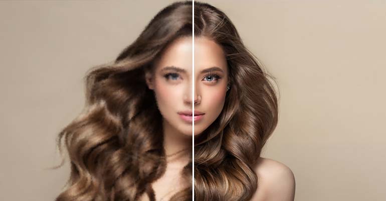 Facial Restoration